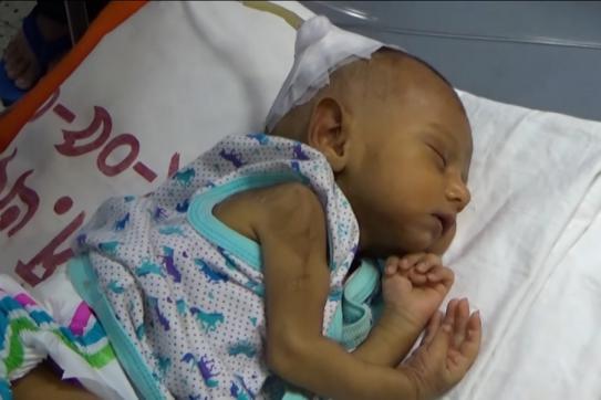 ডাস্টবিনে কুড়িয়ে পাওয়া শিশু আনিশা আর নেই