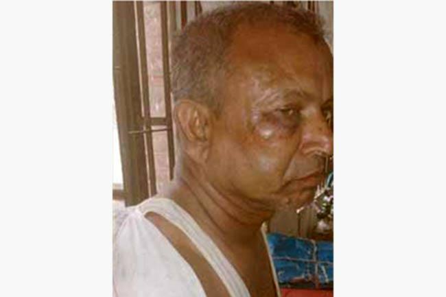 প্রধান শিক্ষককে আ.লীগ নেতার হাতুড়িপেটা!