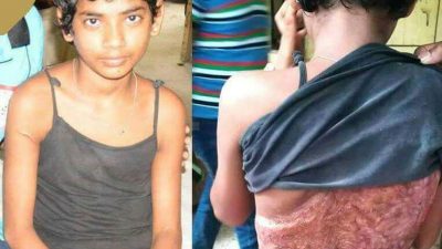 ফেনীতে শিশু গৃহকর্মীকে নির্মম নির্যাতন,গৃহকর্ত্রী পলাতক