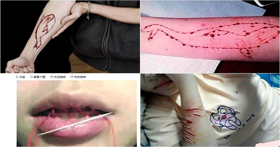 রাজধানীতে ছড়িয়ে পড়া মরণঘাতি ‘ব্লু হোয়েল’ ফাঁদ থেকে আপনার সন্তানকে বাঁচাবেন যেভাবে