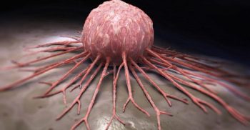 ক্যান্সার রোগ নয়, ব্যবসা !