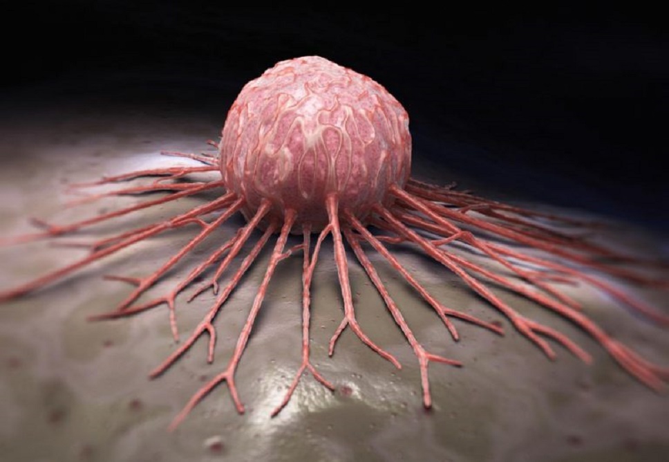 ক্যান্সার রোগ নয়, ব্যবসা !