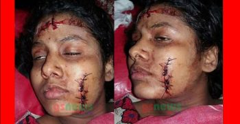 প্রেমে রাজি না হওয়ায়তে মাদ্রাসা ছাত্রীকে কুপিয়েছে শিবির ক্যাডার