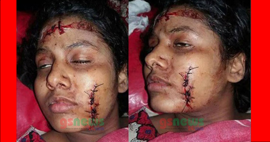 প্রেমে রাজি না হওয়ায়তে মাদ্রাসা ছাত্রীকে কুপিয়েছে শিবির ক্যাডার