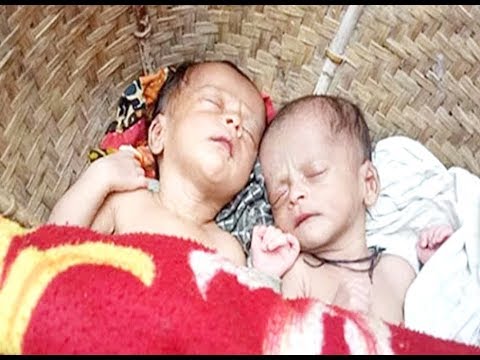 বাবার মৃত্যুর ২ বছর পর জন্মাল যমজ, কীভাবে সম্ভব?