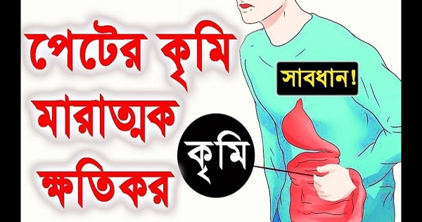 কীভাবে বুঝবেন কৃমি আছে কি না আপনার পেটে?