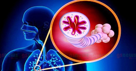 এখনই জেনে নিন হাঁফানির সমস্যা আছে কী না আপনার?