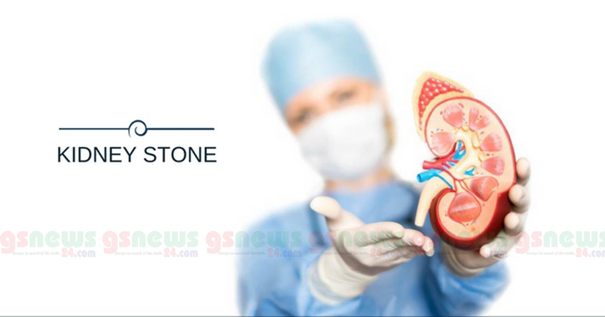কিডনিতে পাথর হতে পারে যেসব ভারসাম্যহীনতার কারণে