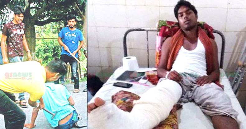 অস্ত্রোপচার লাগবে তরিকুলের পায়ে, অবস্থা আশঙ্কাজনক