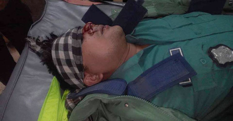 সন্ত্রাসীর বিরুদ্বে অভিযান চালাতে গিয়ে ধারালো অস্ত্রের কোপে আহত পুলিশ, আসামি গুলিবিদ্ধ