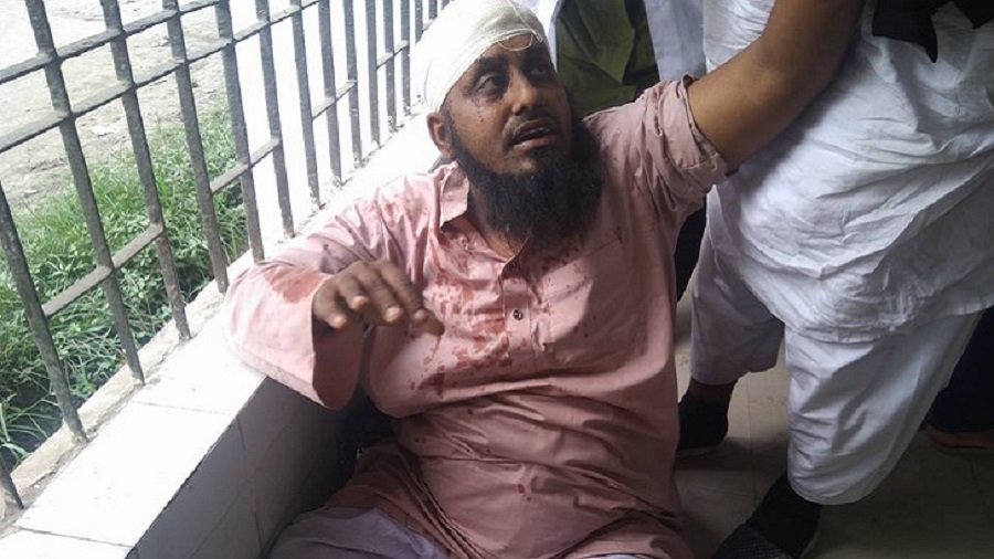 ইজতেমা ময়দান রণক্ষেত্র, শতাধিক মুসল্লি আহত