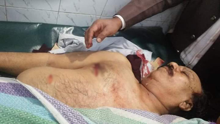 নওগাঁয় নিজ বাসায় দুর্বৃত্তদের ছুরিকাঘাতে আ’লীগ সভাপতি খুন