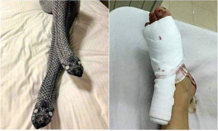 সাপ ভেবে ব্যাট দিয়ে স্ত্রীকে পেটালেন স্বামী