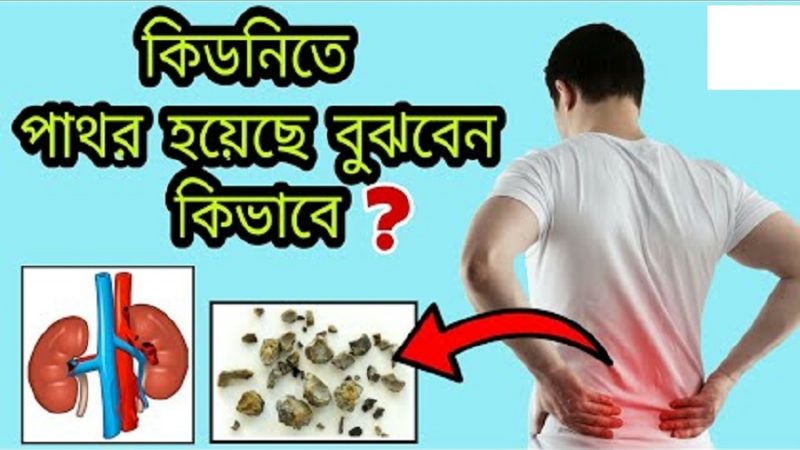 কিডনিতে পাথর জমছে! কিভাবে বুঝবেন?