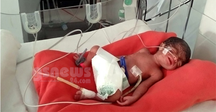 কুমিল্লায় সিজারের পর মৃত্যু ঘোষণা, দাফনের আগে নড়েচড়ে উঠলো