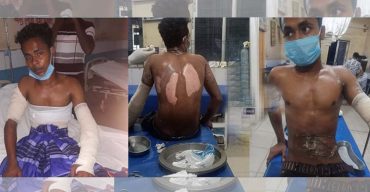 গরম তেলে ঝলসে গেলো ৩ যুবক! আটক ৯