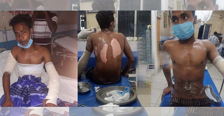 গরম তেলে ঝলসে গেলো ৩ যুবক! আটক ৯