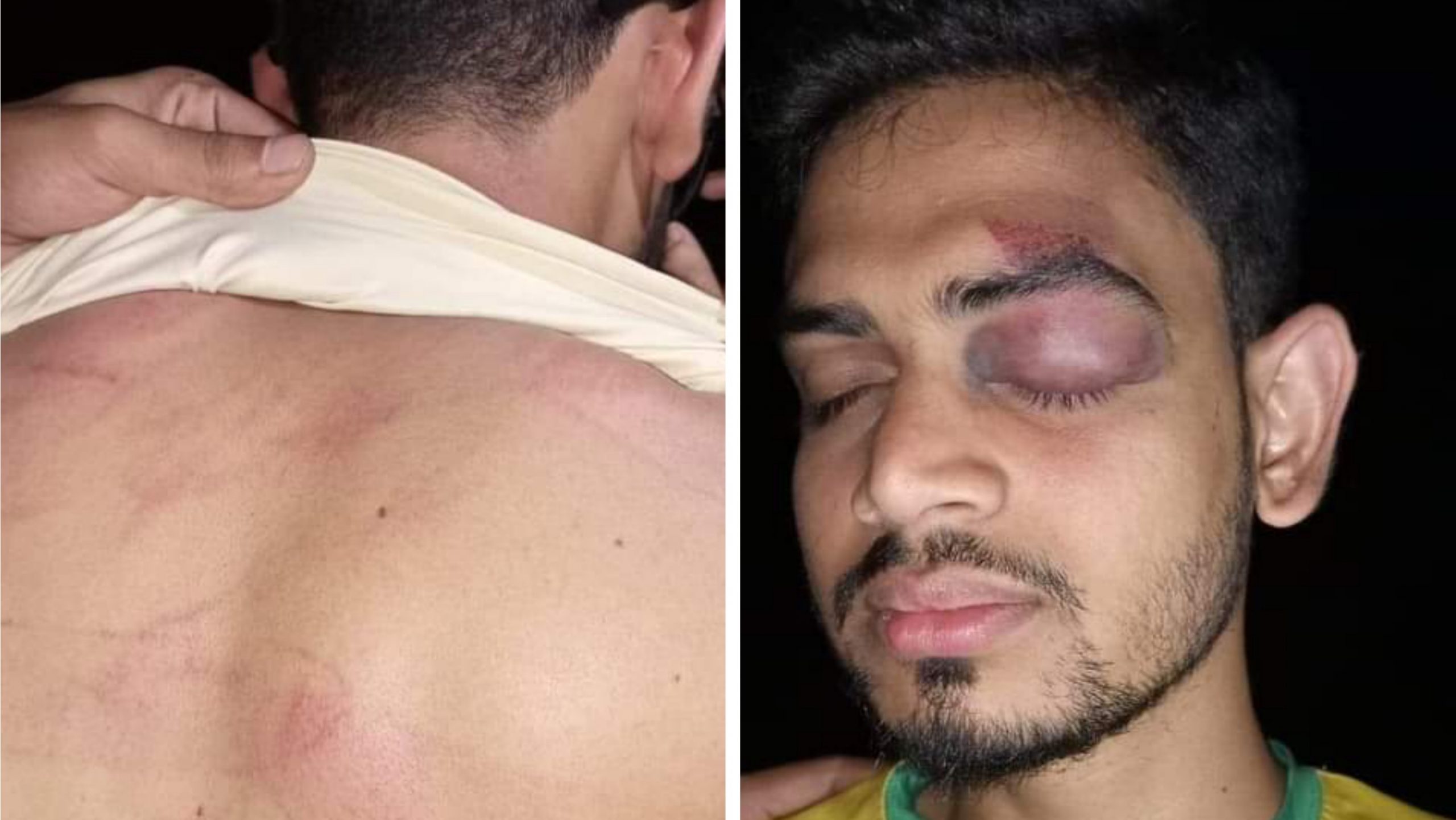 সোনাগাজীর ছাত্রদল নেতাকে কুপিয়ে জখম