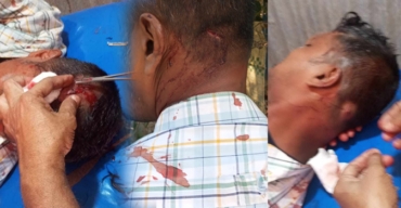 বিদ্যুৎ চুরিতে বাধা দেয়ায় সোনাগাজীতে কৃষকদল নেতাকে কুপিয়ে হত্যার চেষ্টা